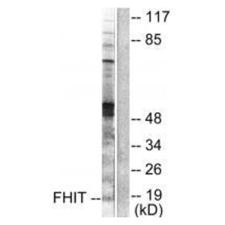 Western blot - FHIT Antibody from Signalway Antibody (33374) - Antibodies.com