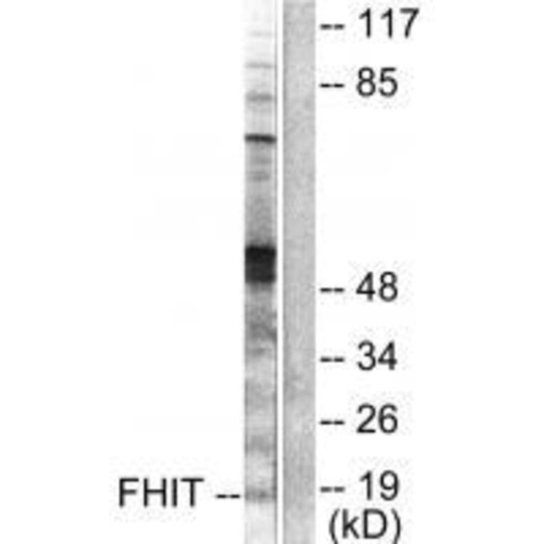 Western blot - FHIT Antibody from Signalway Antibody (33374) - Antibodies.com