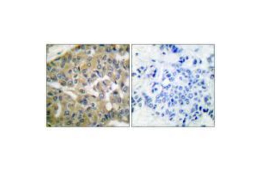 Immunohistochemistry - FHIT Antibody from Signalway Antibody (33374) - Antibodies.com