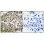 Immunohistochemistry - FHIT Antibody from Signalway Antibody (33374) - Antibodies.com