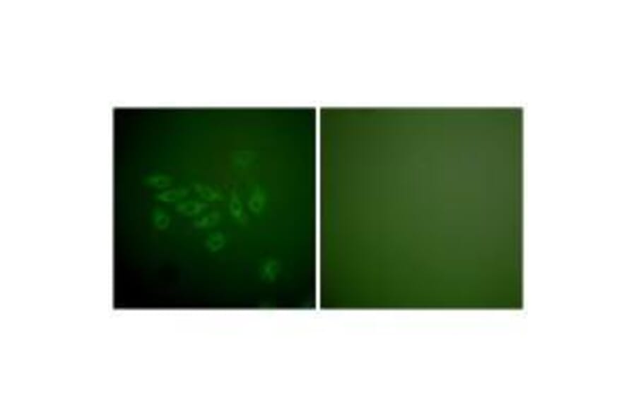 Immunofluorescence - FHIT Antibody from Signalway Antibody (33374) - Antibodies.com