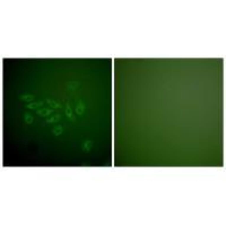 Immunofluorescence - FHIT Antibody from Signalway Antibody (33374) - Antibodies.com