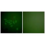 Immunofluorescence - FHIT Antibody from Signalway Antibody (33374) - Antibodies.com