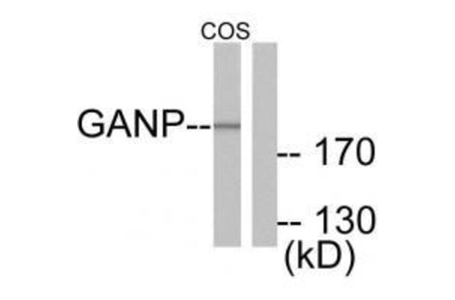 Western blot - GANP Antibody from Signalway Antibody (33383) - Antibodies.com