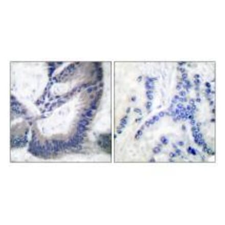 Immunohistochemistry - iNOS Antibody from Signalway Antibody (33424) - Antibodies.com