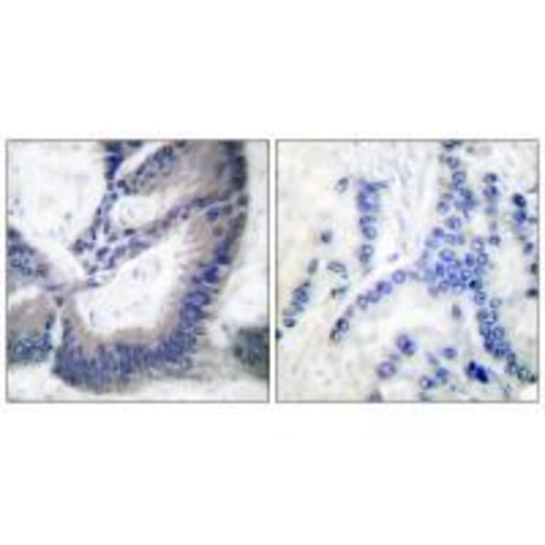 Immunohistochemistry - iNOS Antibody from Signalway Antibody (33424) - Antibodies.com