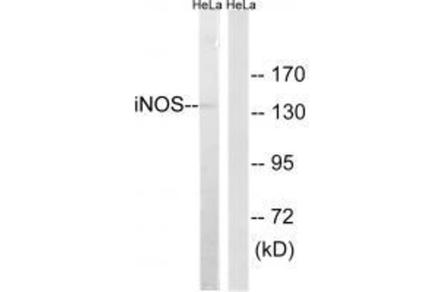 Western blot - iNOS Antibody from Signalway Antibody (33424) - Antibodies.com