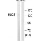Western blot - iNOS Antibody from Signalway Antibody (33424) - Antibodies.com