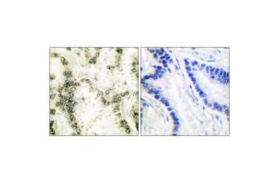 Immunohistochemistry - Ku70 Antibody from Signalway Antibody (33426) - Antibodies.com