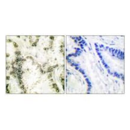 Immunohistochemistry - Ku70 Antibody from Signalway Antibody (33426) - Antibodies.com