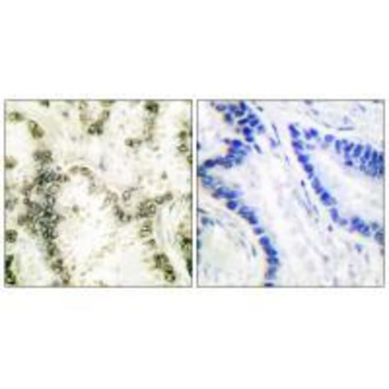 Immunohistochemistry - Ku70 Antibody from Signalway Antibody (33426) - Antibodies.com