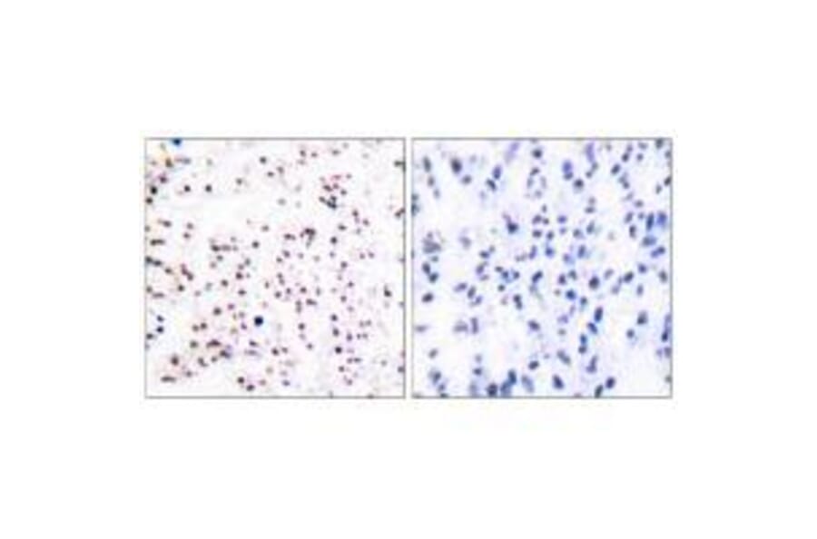 Immunohistochemistry - MCM5 Antibody from Signalway Antibody (33432) - Antibodies.com