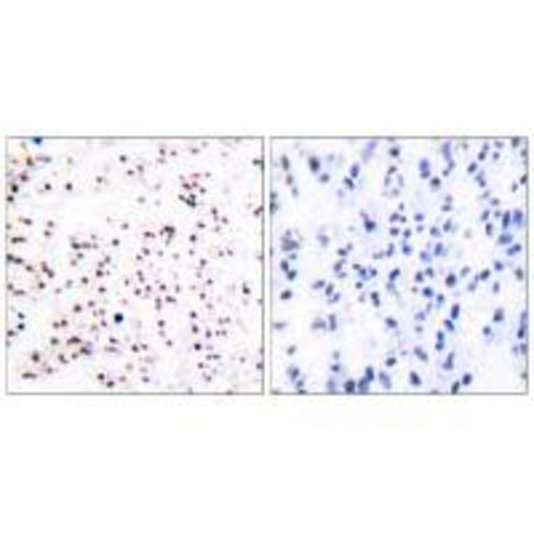 Immunohistochemistry - MCM5 Antibody from Signalway Antibody (33432) - Antibodies.com