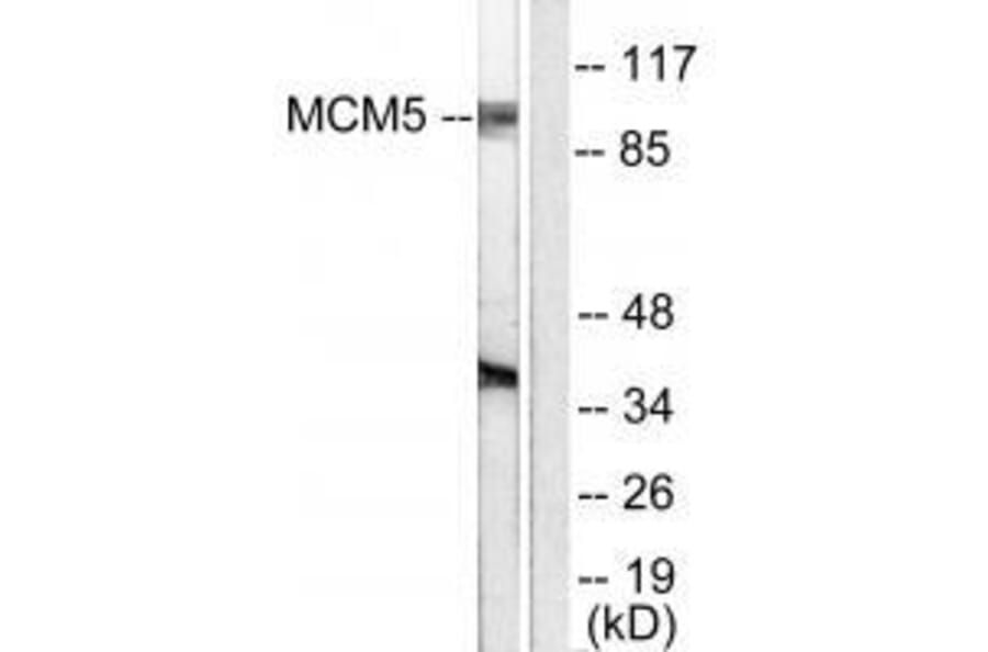 Western blot - MCM5 Antibody from Signalway Antibody (33432) - Antibodies.com
