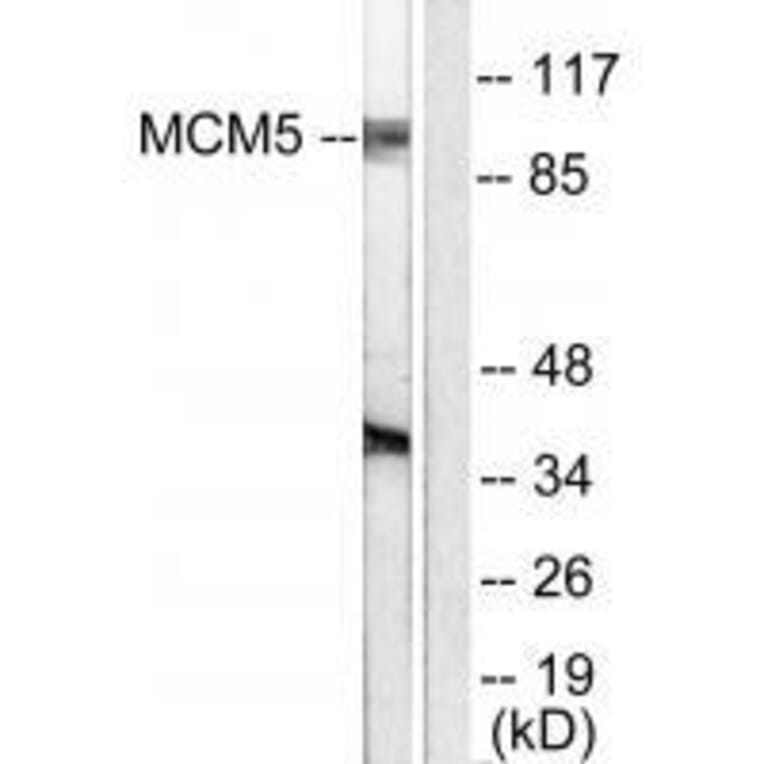 Western blot - MCM5 Antibody from Signalway Antibody (33432) - Antibodies.com