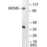 Western blot - MCM5 Antibody from Signalway Antibody (33432) - Antibodies.com