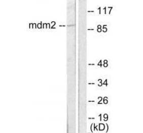 Western blot - MDM2 Antibody from Signalway Antibody (33433) - Antibodies.com