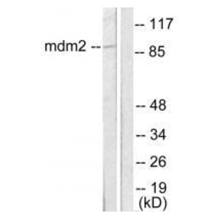 Western blot - MDM2 Antibody from Signalway Antibody (33433) - Antibodies.com