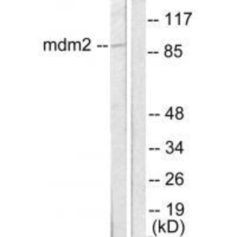 Western blot - MDM2 Antibody from Signalway Antibody (33433) - Antibodies.com