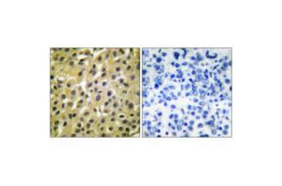 Immunohistochemistry - MDM2 Antibody from Signalway Antibody (33433) - Antibodies.com