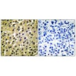 Immunohistochemistry - MDM2 Antibody from Signalway Antibody (33433) - Antibodies.com