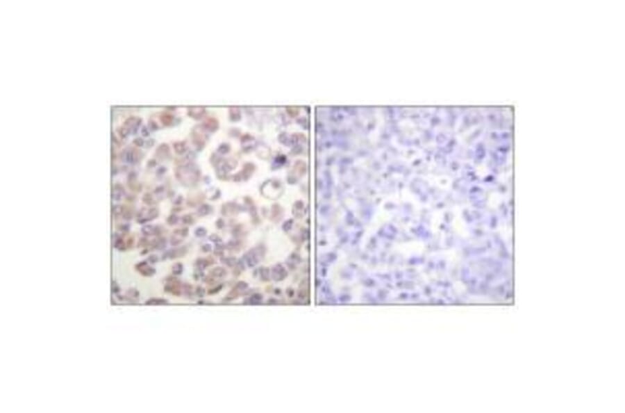 Immunohistochemistry - WNT1 Antibody from Signalway Antibody (33543) - Antibodies.com