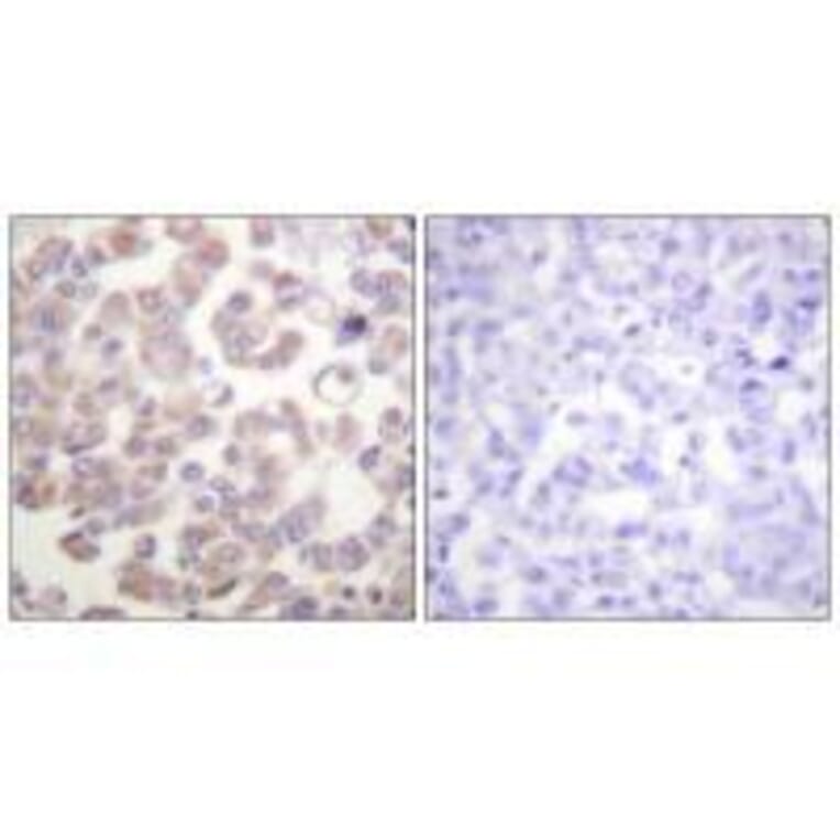 Immunohistochemistry - WNT1 Antibody from Signalway Antibody (33543) - Antibodies.com