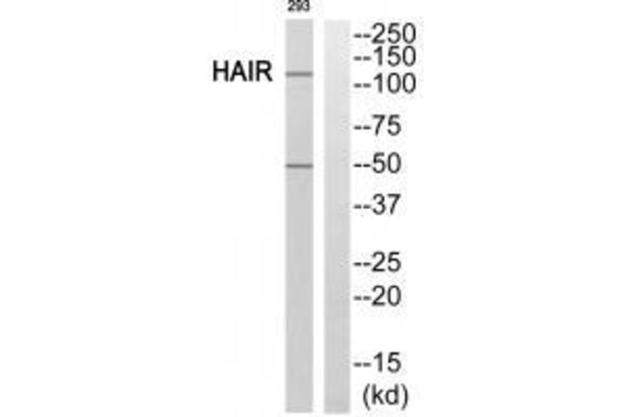 Western blot - HAIR Antibody from Signalway Antibody (33588) - Antibodies.com