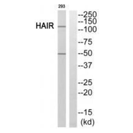 Western blot - HAIR Antibody from Signalway Antibody (33588) - Antibodies.com