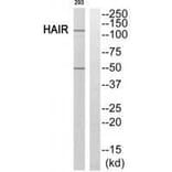 Western blot - HAIR Antibody from Signalway Antibody (33588) - Antibodies.com