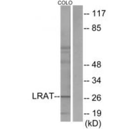 Western blot - LRAT Antibody from Signalway Antibody (33628) - Antibodies.com