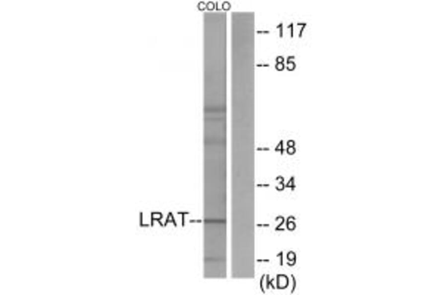 Western blot - LRAT Antibody from Signalway Antibody (33628) - Antibodies.com