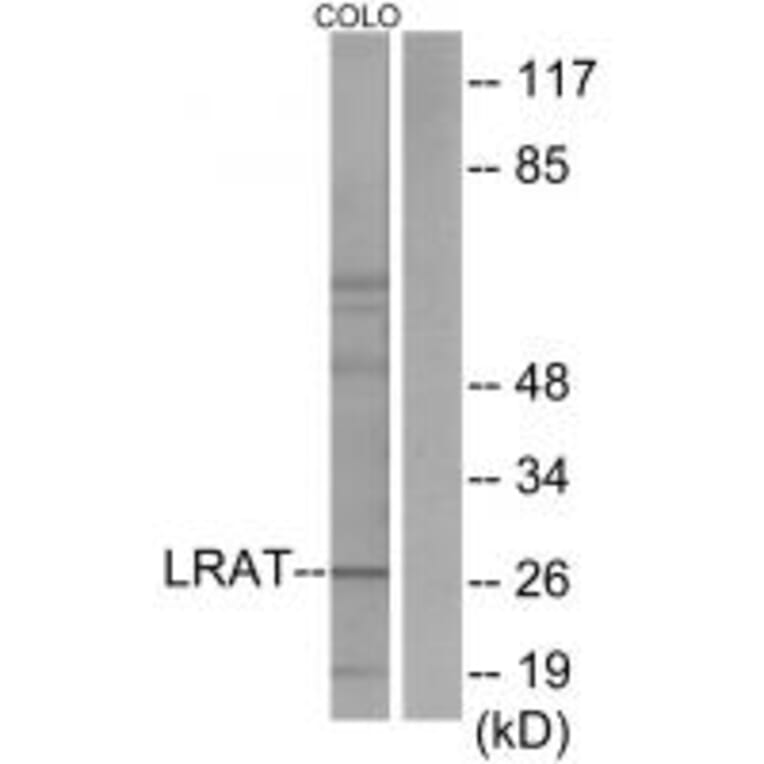 Western blot - LRAT Antibody from Signalway Antibody (33628) - Antibodies.com