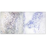Immunohistochemistry - LRAT Antibody from Signalway Antibody (33628) - Antibodies.com