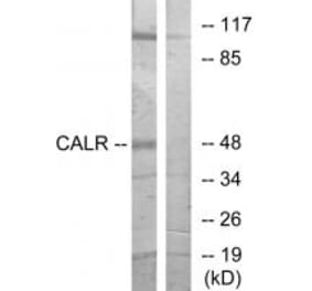 Western blot - CALR Antibody from Signalway Antibody (33733) - Antibodies.com