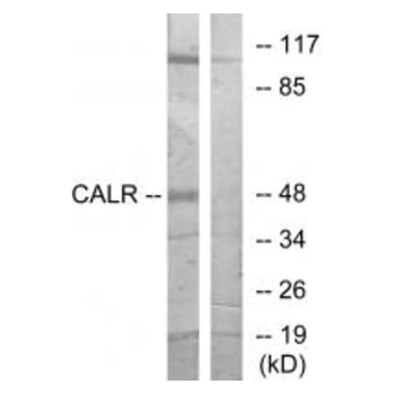 Western blot - CALR Antibody from Signalway Antibody (33733) - Antibodies.com