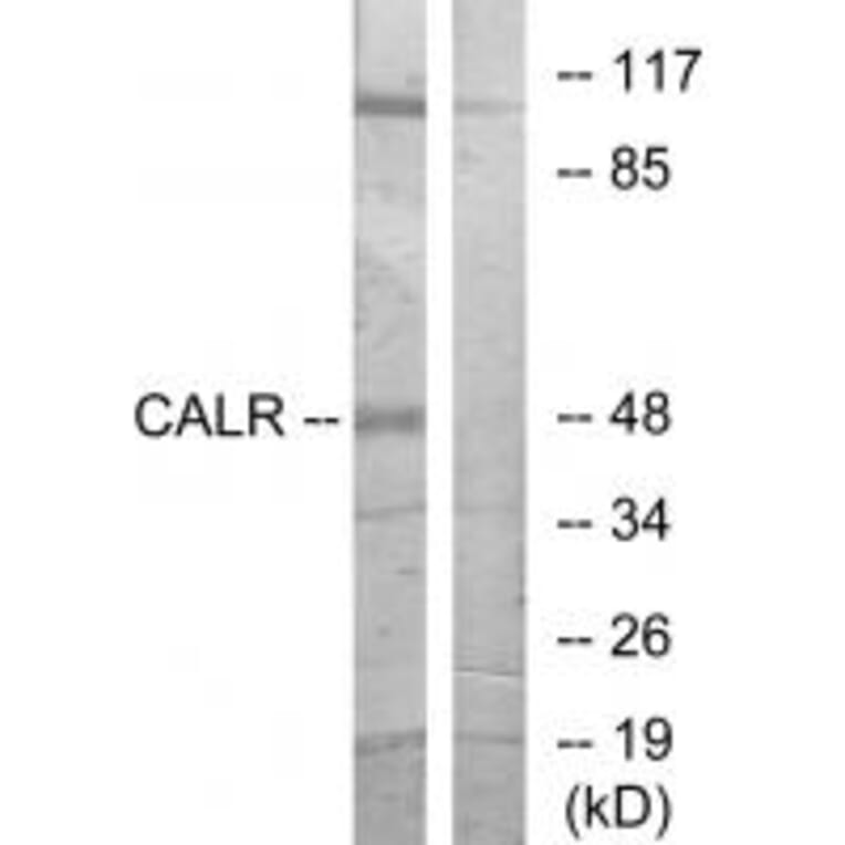 Western blot - CALR Antibody from Signalway Antibody (33733) - Antibodies.com