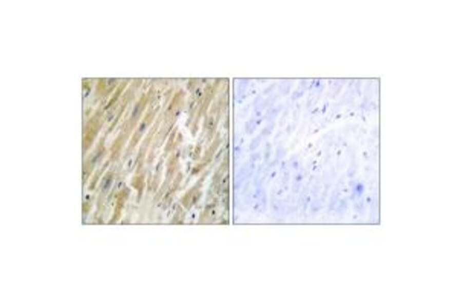 Immunohistochemistry - CALR Antibody from Signalway Antibody (33733) - Antibodies.com