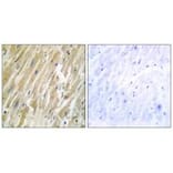 Immunohistochemistry - CALR Antibody from Signalway Antibody (33733) - Antibodies.com