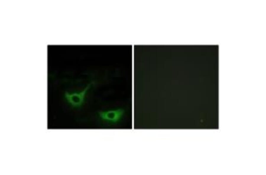 Immunofluorescence - CALR Antibody from Signalway Antibody (33733) - Antibodies.com