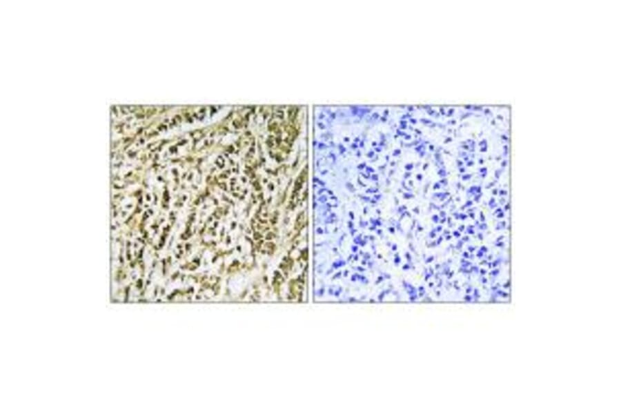 Immunohistochemistry - FEN1 Antibody from Signalway Antibody (33763) - Antibodies.com