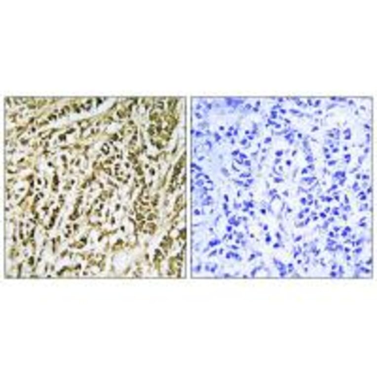 Immunohistochemistry - FEN1 Antibody from Signalway Antibody (33763) - Antibodies.com