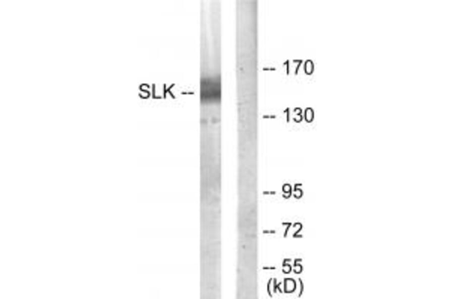 Western blot - SLK Antibody from Signalway Antibody (34060) - Antibodies.com