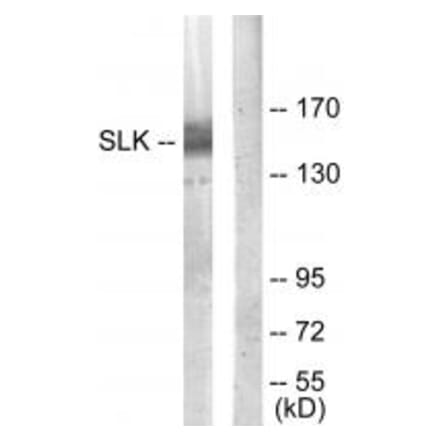 Western blot - SLK Antibody from Signalway Antibody (34060) - Antibodies.com