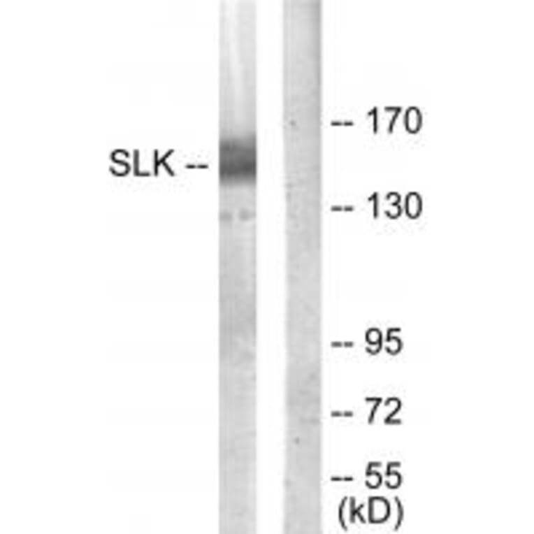 Western blot - SLK Antibody from Signalway Antibody (34060) - Antibodies.com