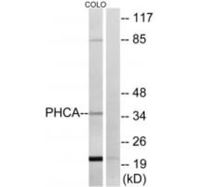 Western blot - PHCA Antibody from Signalway Antibody (34405) - Antibodies.com