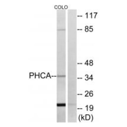Western blot - PHCA Antibody from Signalway Antibody (34405) - Antibodies.com