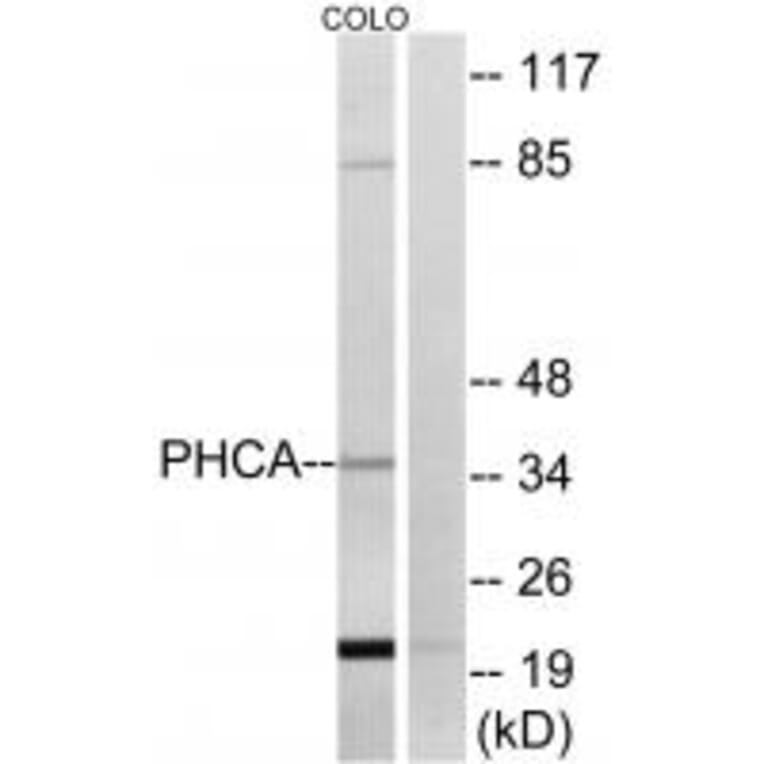 Western blot - PHCA Antibody from Signalway Antibody (34405) - Antibodies.com