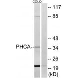 Western blot - PHCA Antibody from Signalway Antibody (34405) - Antibodies.com