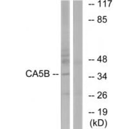 Western blot - CA5B Antibody from Signalway Antibody (34542) - Antibodies.com